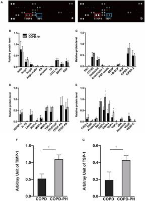 TIMP-1: A Circulating Biomarker for Pulmonary Hypertension Diagnosis Among Chronic Obstructive Pulmonary Disease Patients